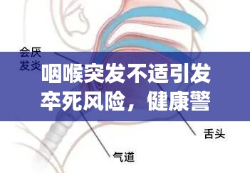 咽喉突发不适引发卒死风险,健康警钟长鸣!